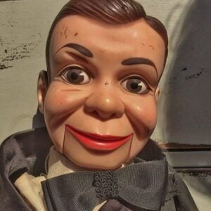 The Surgical Secret to Marionette Lines No One Else Tells You – TEST