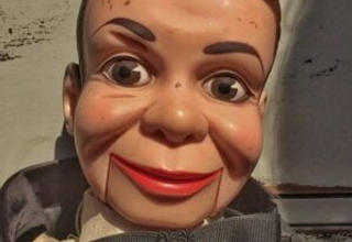The Surgical Secret to Marionette Lines No One Else Tells You – TEST