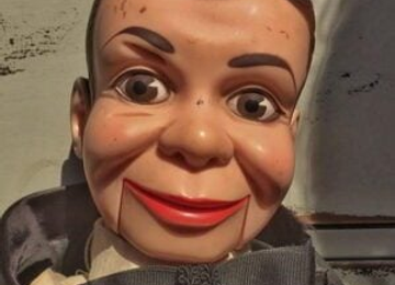 The Surgical Secret to Marionette Lines No One Else Tells You – TEST